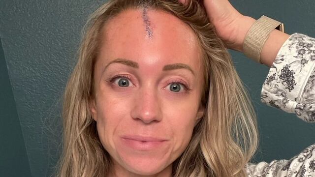 Reportera de Grandes Ligas sufre brutal pelotazo; así lo presumió