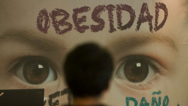 Obesidad