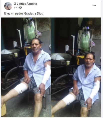 El hombre resultó lesionado