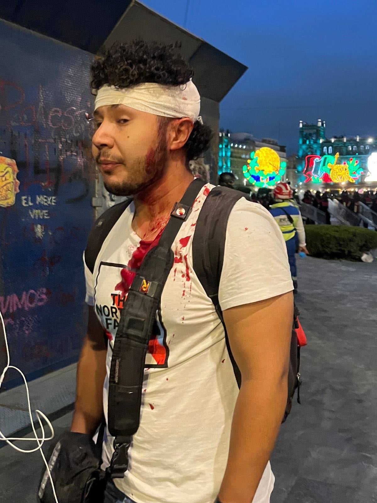 Juan Felipe Abundis, periodista agredido durante marcha 2 de octubre CDMX