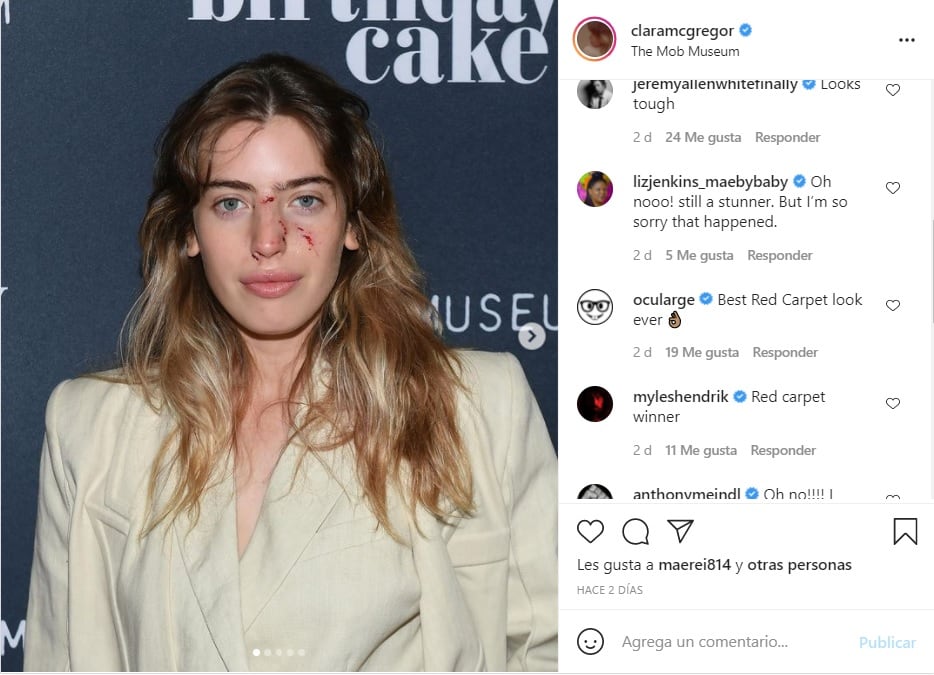 Clara McGregor asiste a una alfombra roja tras ser mordida por un perro