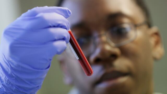 Vacuna contra el Covid-19