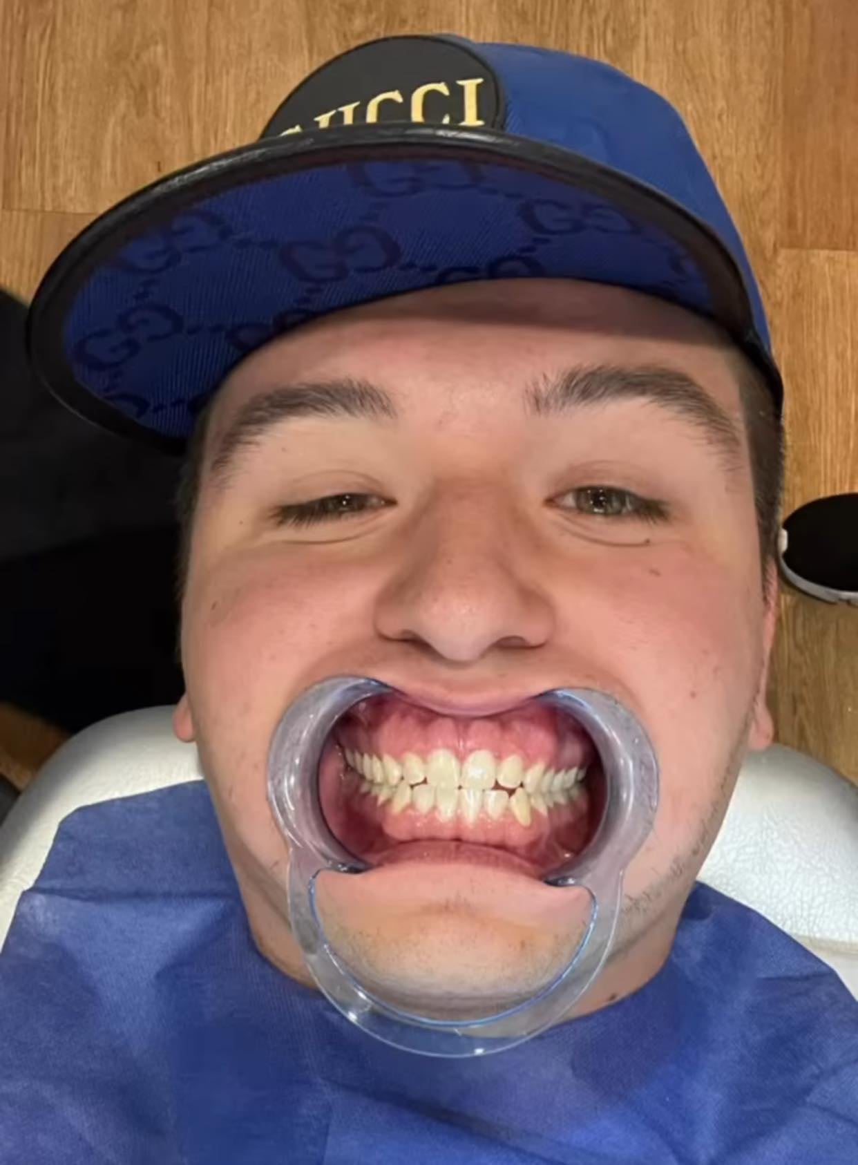 Fofo Márquez y sus nuevos dientes