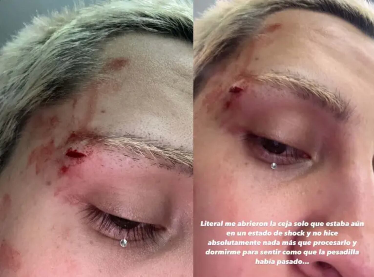 Kunno fue golpeado en ataque homofóbico en Monterrey