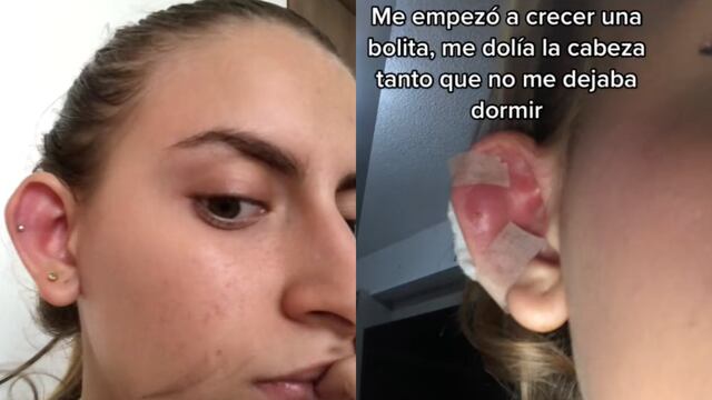 Piercing sale mal y lo sube a TikTok