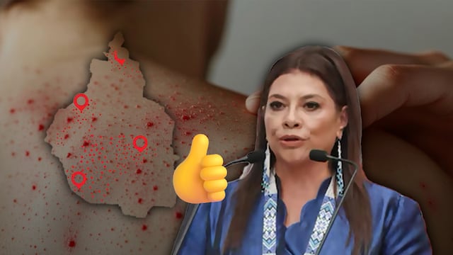 Clara Brugada da por superado el sarampión en la Ciudad de México
