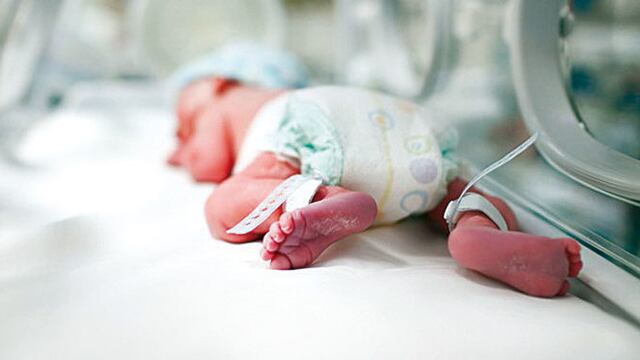 ¿Qué es el Síndrome de Edwards? Esto debes saber de la Trisomía 18