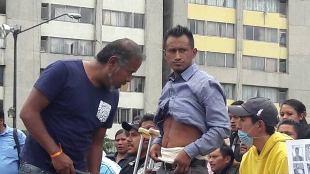 Herido de Nochixtlán