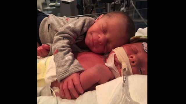 Gemelos recién abrazados.