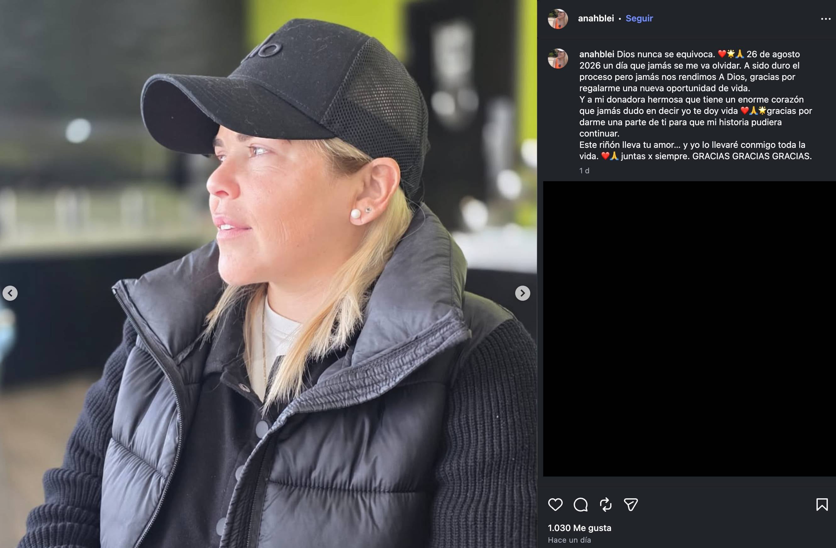 Ana Lucía Bleizeffer compartió que se sometería a un segundo trasplante de riñón