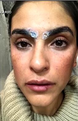Liz Gallardo compartió las quemaduras tras procedimiento por el microblading.