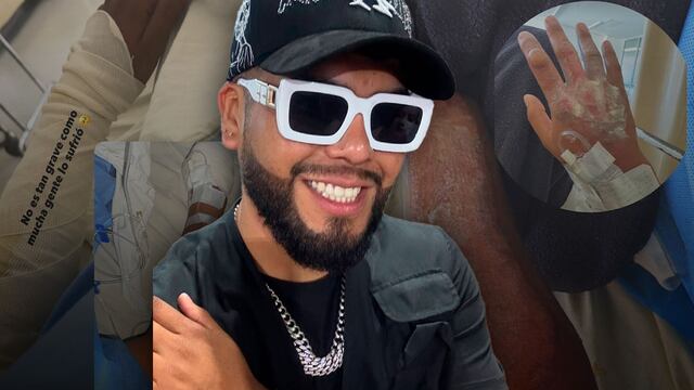 J LU Barber Cervantes, influencer y víctima de la explosión en Iztapalapa