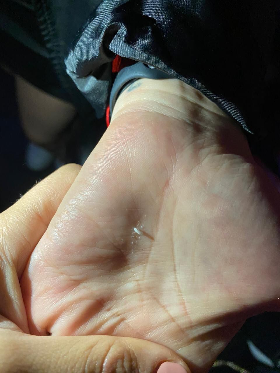 En el trago había un cuerpo extraño en los hielos.