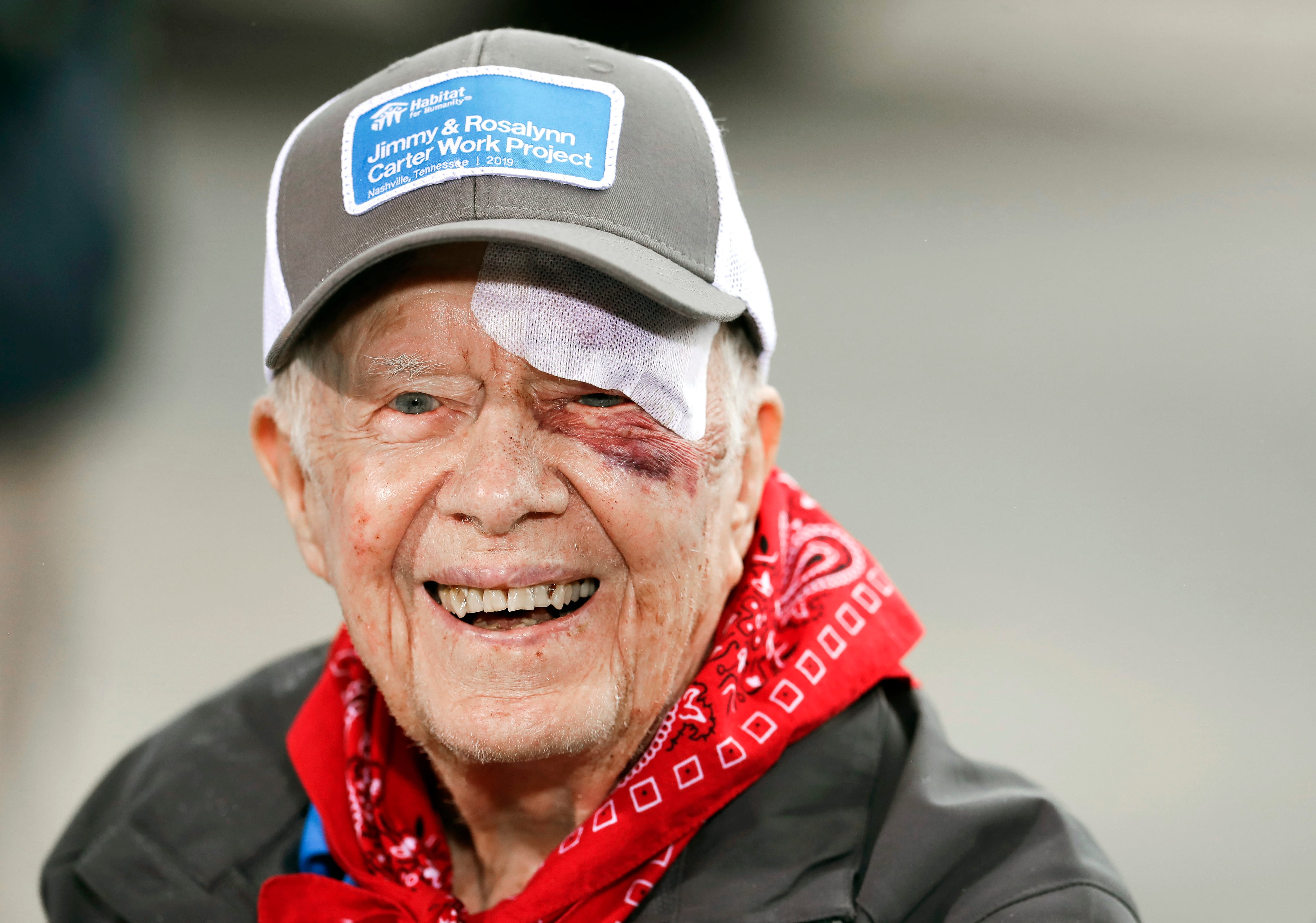 Jimmy Carter. Herido tras caída.