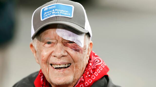 Jimmy Carter. Herido tras caída.