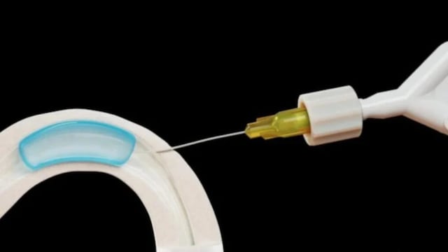 El anticonceptivo ADAM para hombre que impide que los espermas salgan cuando termines