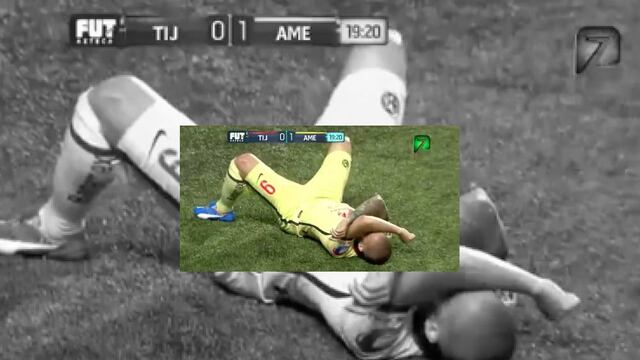 Dario Benedetto sale lesionado del encuentro ante Tijuana