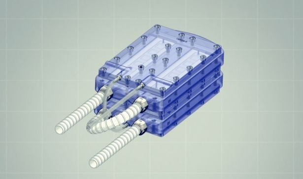 Riñón bioartificial 'Kidney X'