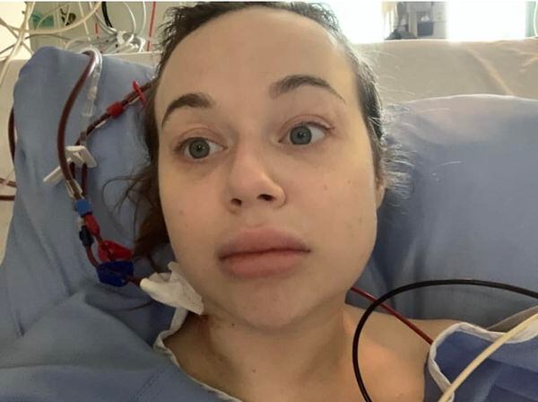 Una borrachera casi la deja sin pierna; se desmayó y esto vio al despertar (FOTOS)