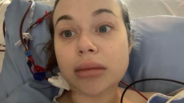 Una borrachera casi la deja sin pierna; se desmayó y esto vio al despertar (FOTOS)