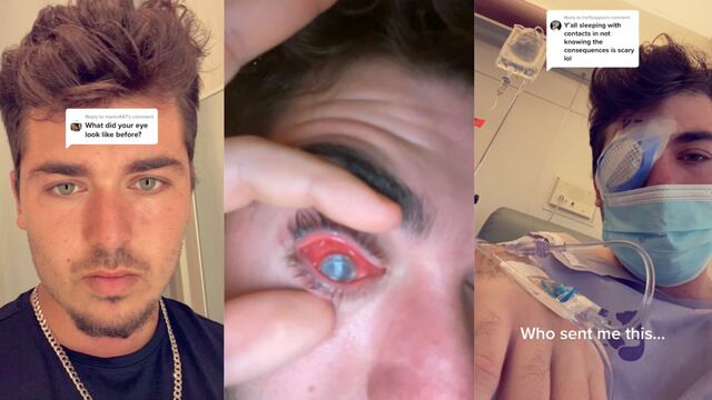 Toma una siesta y despierta ciego; un parásito en su ojo provocó la tragedia