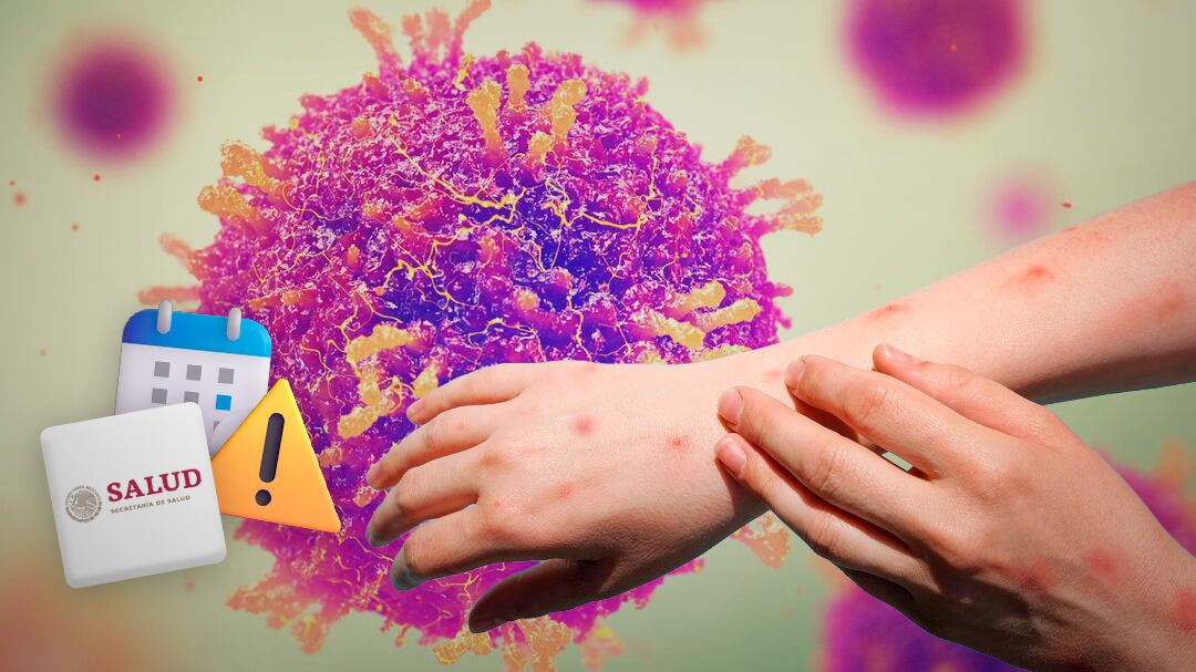 Sarampión es más contagioso que COVID-19; Salud pide dos meses para controlarlo