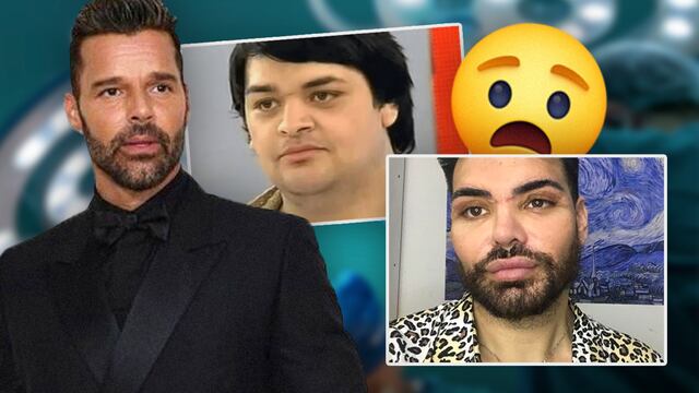 Se operó más de 30 veces para parecerse a Ricky Martin
