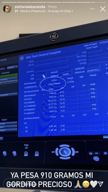 Stefanía de Aranda informa que su bebé está bien