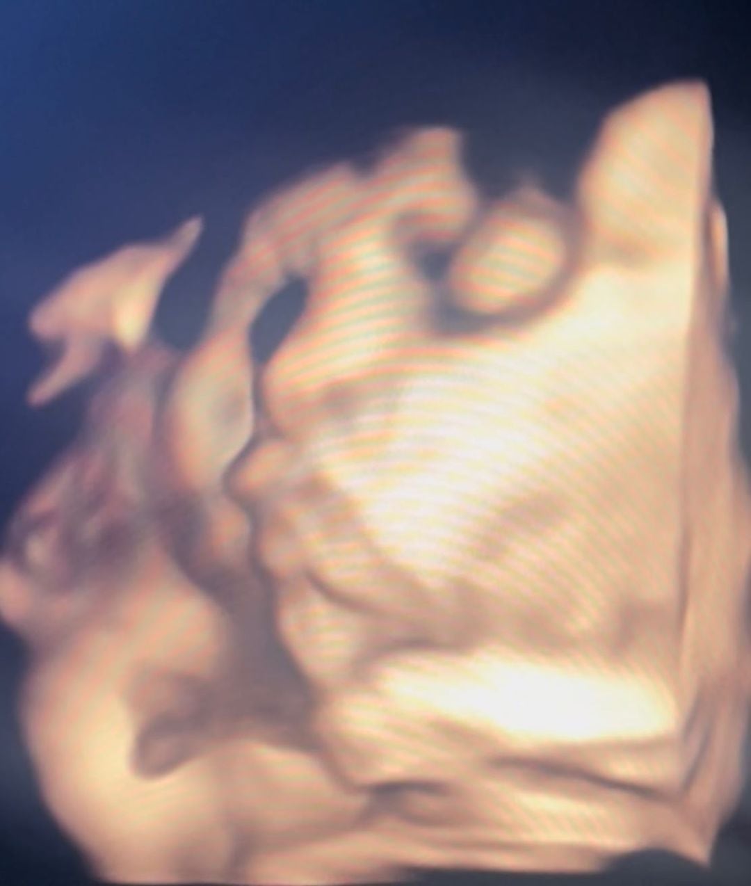 Geraldine Ponce comparte primera foto de ultrasonido de su bebé