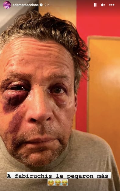 Así quedó Alfredo Adame tras golpiza