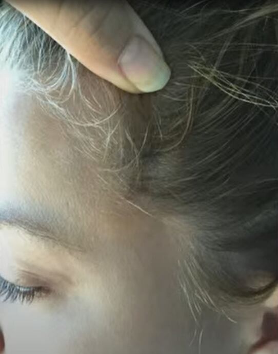 Cabeza de Amber Heard golpeada