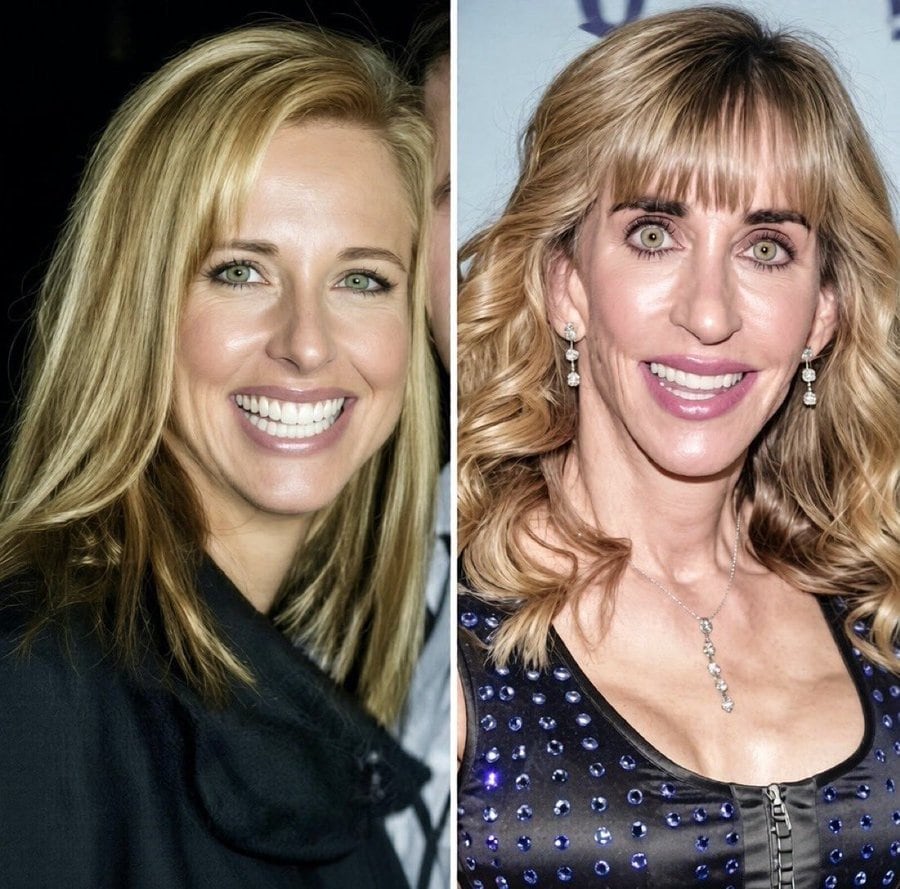 Susan Dell se vuelve viral: fotos de su “antes y después” generan reacciones en redes