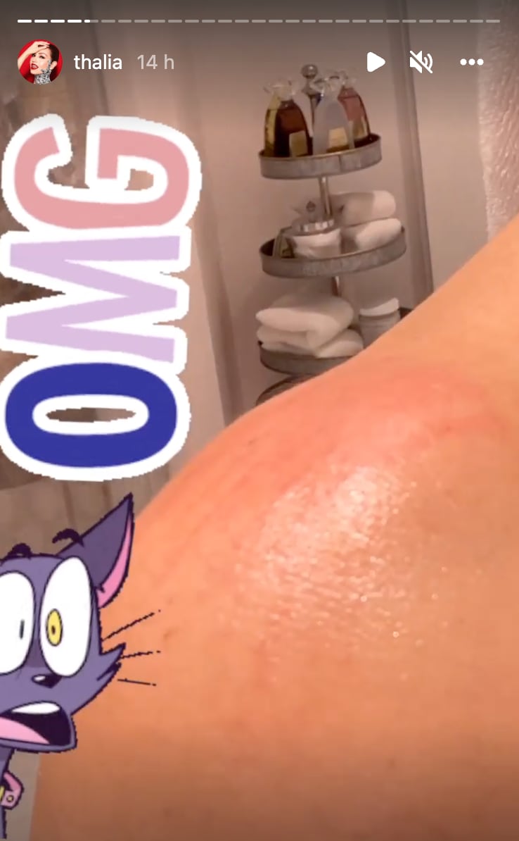 Thalía muestra sus heridas
