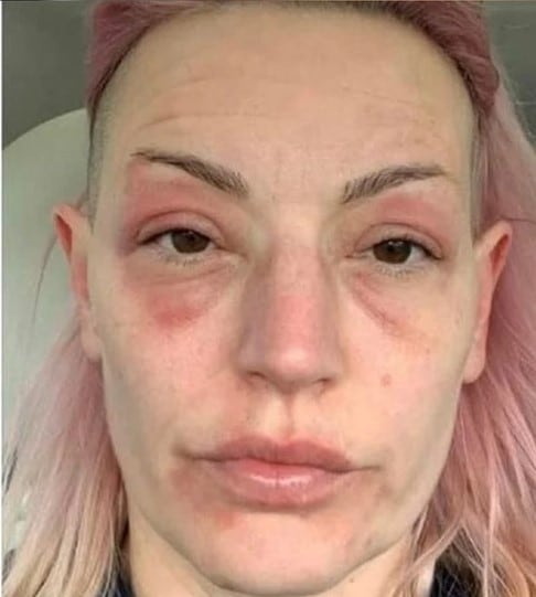 Michelle Flower, la mujer que envejeció al vacunarse contra el Covid-19