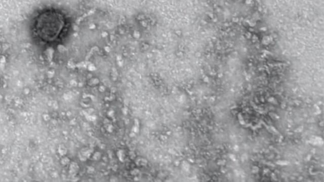 Así se ve el SARS-CoV-2.