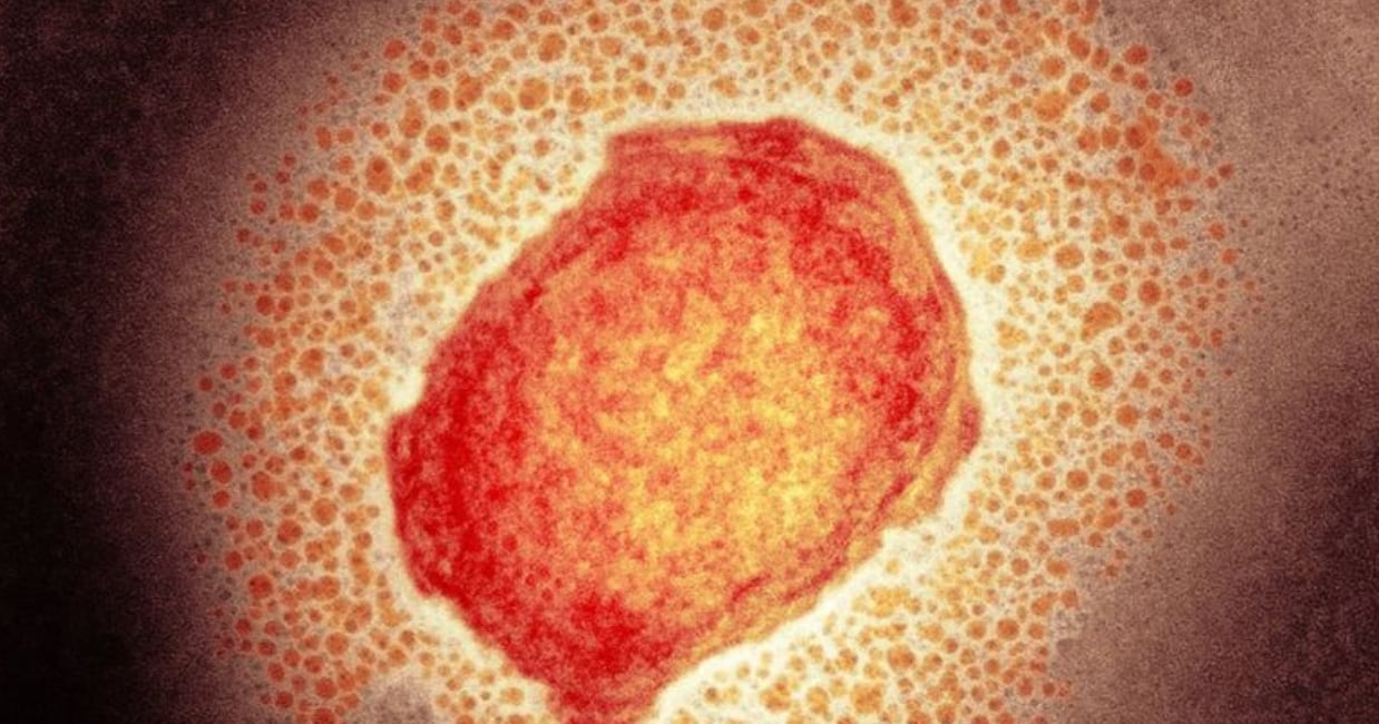 Partícula de 'virus del mono'