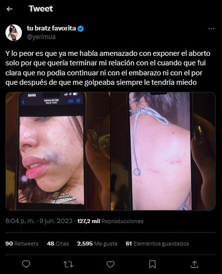 Yeri Mua comparte fotos de las agresiones de Naim Darrechi