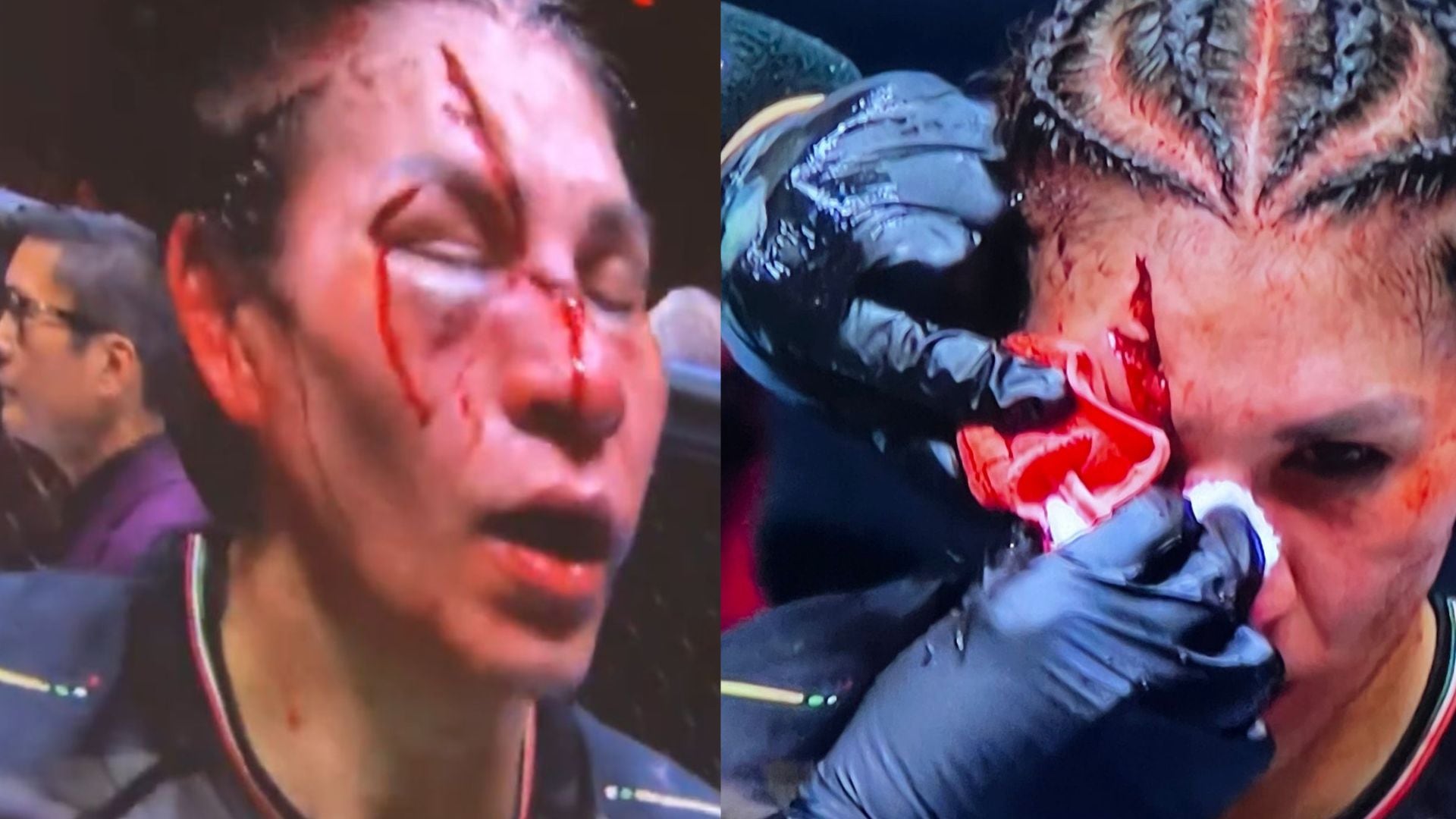 Herida de Irene Aldana en la Noche UFC 306.