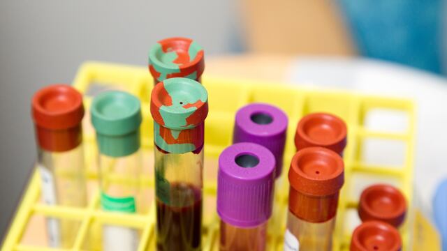 Terapia de suero convaleciente contra el Covid-19