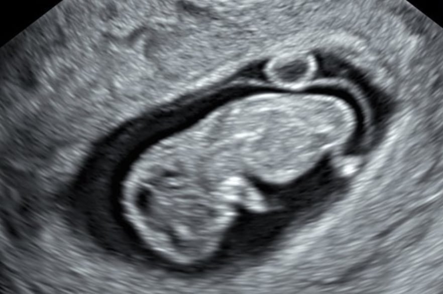 Mariana Rodríguez y Samuel García anuncian un muy deseado embarazo