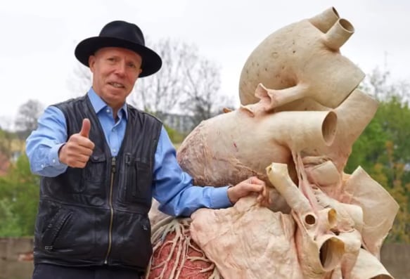 Gunther von Hagens
