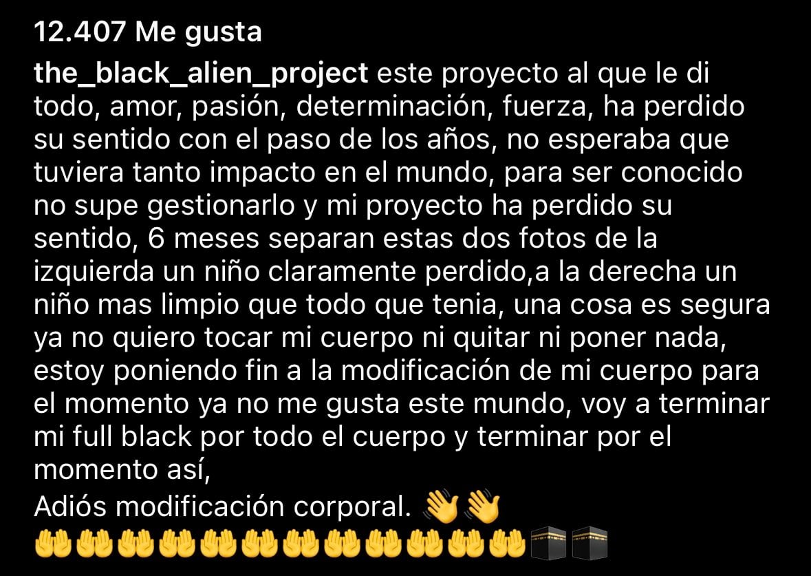 Black Alien anuncia que deja sus modificaciones corporales.
