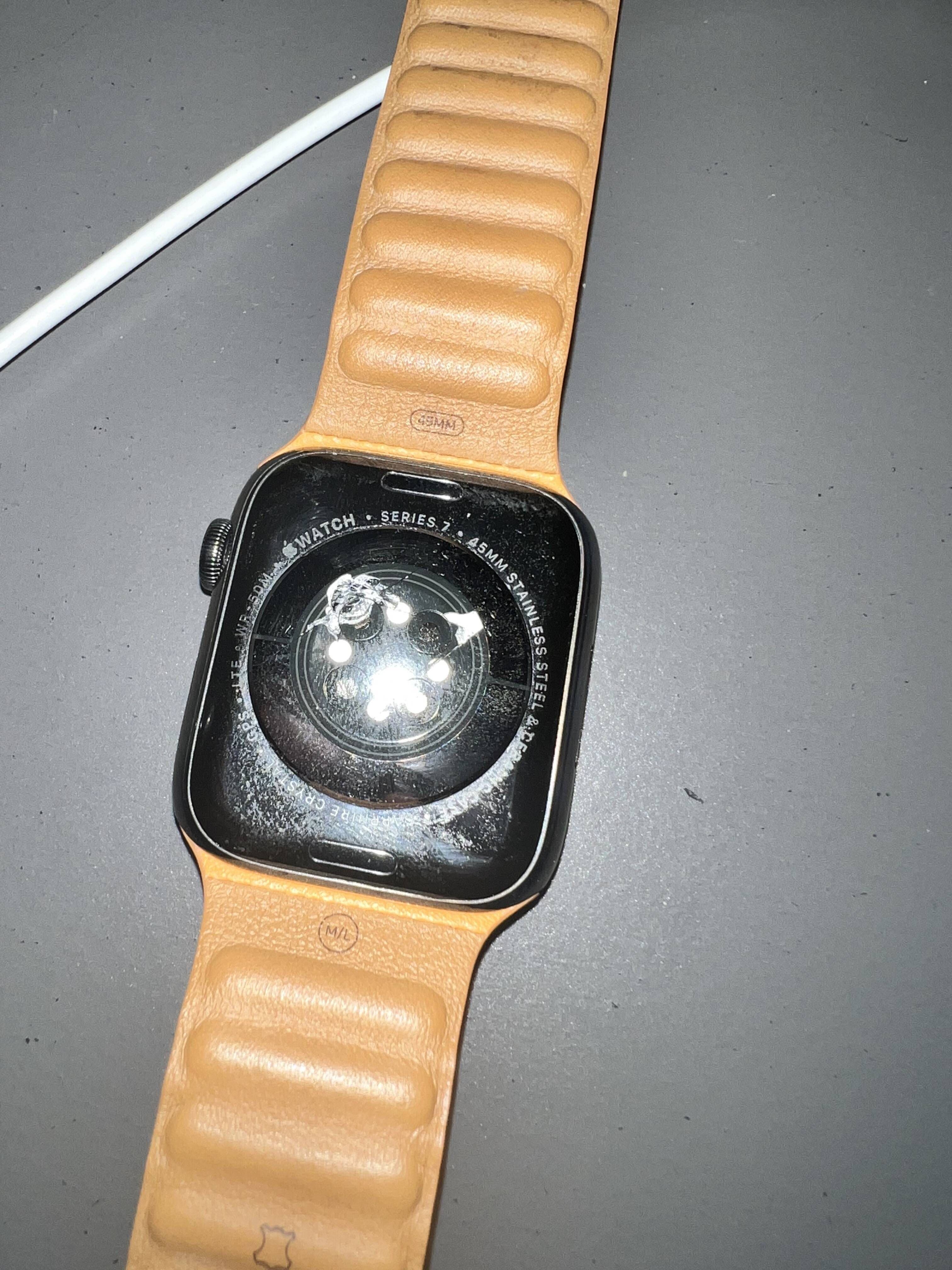 Su Apple Watch se sobrecalienta y termina en el servicio de urgencias (VIDEO)