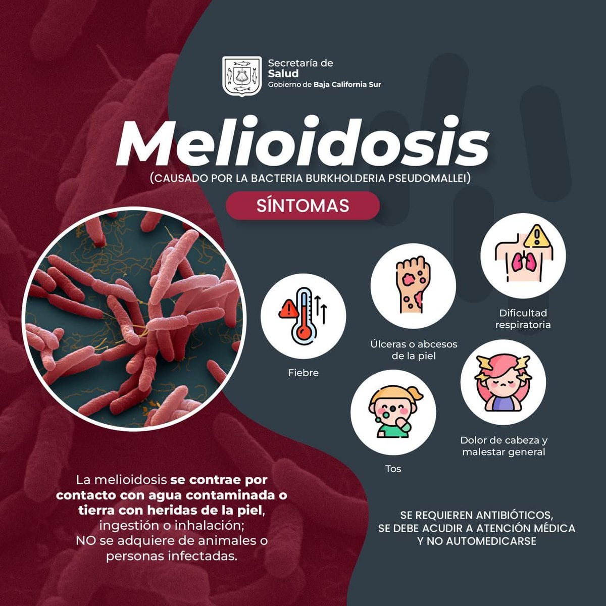 Melioidosis: enfermedad provocada por la bacteria Burkholderia