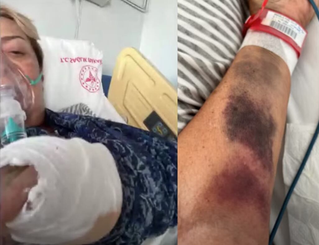 Sylvia Pasque sufre accidente en Turquía