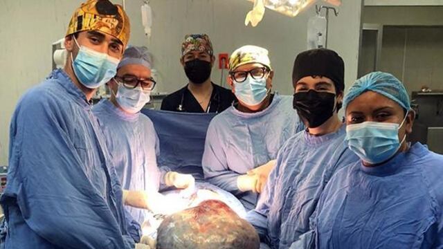 Quitan a mujer un tumor de 21 kilos en León