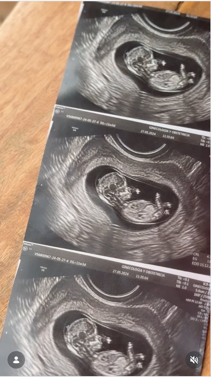 Mariana Rodríguez creó la imagen de ecografía de su embarazo con ChatGPT