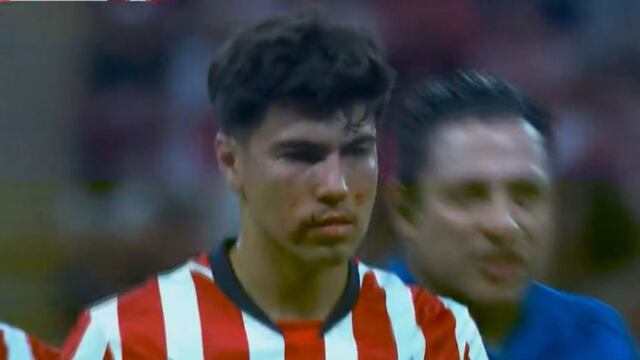 Codazo de Alexis Vega a Érick Gutiérrez.