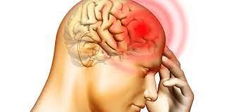 Meningitis