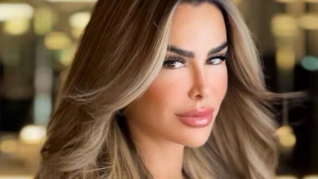 Ninel Conde, botox